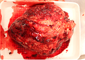 Cow heart with suspected cyanide poisoning.